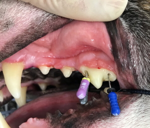 歯肉の腫脹
